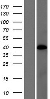 PRR5L / FLJ14213 Protein - Western validation with an anti-DDK antibody * L: Control HEK293 lysate R: Over-expression lysate