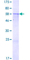 PRR7 Protein - 12.5% SDS-PAGE of human PRR7 stained with Coomassie Blue