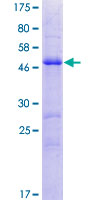 PRRG4 Protein - 12.5% SDS-PAGE of human PRRG4 stained with Coomassie Blue