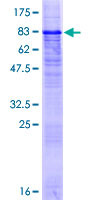 PRRT2 Protein - 12.5% SDS-PAGE of human PRRT2 stained with Coomassie Blue