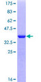 PRRX2 / PRX2 Protein - 12.5% SDS-PAGE Stained with Coomassie Blue.