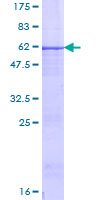 PRSS1 / Trypsin Protein - 12.5% SDS-PAGE of human PRSS1 stained with Coomassie Blue