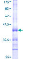PRSS1 / Trypsin Protein - 12.5% SDS-PAGE Stained with Coomassie Blue.