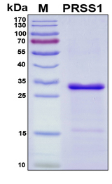 PRSS1 / Trypsin Protein - SDS-PAGE under reducing conditions and visualized by Coomassie blue staining