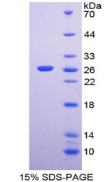 PRSS2 / Trypsin 2 Protein - Recombinant  Protease, Serine 2 By SDS-PAGE