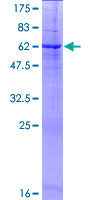 PRSS21 / Testisin Protein - 12.5% SDS-PAGE of human PRSS21 stained with Coomassie Blue