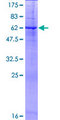 PRSS21 / Testisin Protein - 12.5% SDS-PAGE of human PRSS21 stained with Coomassie Blue
