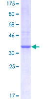 PRSS21 / Testisin Protein - 12.5% SDS-PAGE Stained with Coomassie Blue.