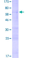 PRSS23 Protein - 12.5% SDS-PAGE of human PRSS23 stained with Coomassie Blue