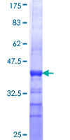 PRSS27 / CAPH2 Protein - 12.5% SDS-PAGE Stained with Coomassie Blue.