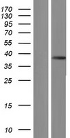 PRSS3 / Trypsin 3 Protein - Western validation with an anti-DDK antibody * L: Control HEK293 lysate R: Over-expression lysate