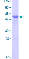 PRSS3 / Trypsin 3 Protein - 12.5% SDS-PAGE of human PRSS3 stained with Coomassie Blue
