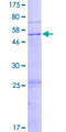 PRSS33 Protein - 12.5% SDS-PAGE of human PRSS33 stained with Coomassie Blue