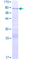PRSS35 Protein - 12.5% SDS-PAGE of human PRSS35 stained with Coomassie Blue