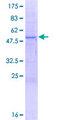 PRSS37 Protein - 12.5% SDS-PAGE of human LOC136242 stained with Coomassie Blue