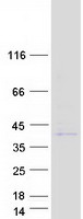 PRSS42 Protein - Purified recombinant protein PRSS42 was analyzed by SDS-PAGE gel and Coomassie Blue Staining