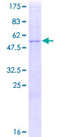 PRSS45 Protein - 12.5% SDS-PAGE of human TESSP5 stained with Coomassie Blue