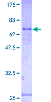 PRSS50 / TSP50 Protein - 12.5% SDS-PAGE of human TSP50 stained with Coomassie Blue