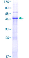 PRSS58 Protein - 12.5% SDS-PAGE of human TRY1 stained with Coomassie Blue