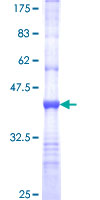 PRSS8 / Prostasin Protein - 12.5% SDS-PAGE Stained with Coomassie Blue.