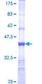 PRSS8 / Prostasin Protein - 12.5% SDS-PAGE Stained with Coomassie Blue.