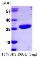 PRTFDC1 / HHGP Protein