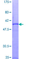 PRTN3 / Myeloblastin Protein - 12.5% SDS-PAGE of human PRTN3 stained with Coomassie Blue