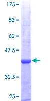PRTN3 / Myeloblastin Protein - 12.5% SDS-PAGE Stained with Coomassie Blue.