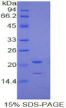 PRTN3 / Myeloblastin Protein