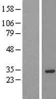 PRUNE2 Protein - Western validation with an anti-DDK antibody * L: Control HEK293 lysate R: Over-expression lysate