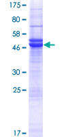 PRUNE2 Protein - 12.5% SDS-PAGE of human PRUNE2 stained with Coomassie Blue