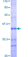 PRX-1 / PRRX1 Protein - 12.5% SDS-PAGE Stained with Coomassie Blue.