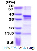 PRX-1 / PRRX1 Protein