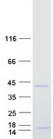 PRX-1 / PRRX1 Protein - Purified recombinant protein PRRX1 was analyzed by SDS-PAGE gel and Coomassie Blue Staining
