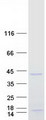 PRX-1 / PRRX1 Protein - Purified recombinant protein PRRX1 was analyzed by SDS-PAGE gel and Coomassie Blue Staining