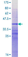 PRY Protein - 12.5% SDS-PAGE Stained with Coomassie Blue.