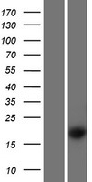 PS20 / WFDC1 Protein - Western validation with an anti-DDK antibody * L: Control HEK293 lysate R: Over-expression lysate