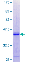 PS20 / WFDC1 Protein - 12.5% SDS-PAGE Stained with Coomassie Blue.