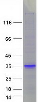 PS20 / WFDC1 Protein - Purified recombinant protein WFDC1 was analyzed by SDS-PAGE gel and Coomassie Blue Staining