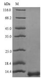 PSAP / Prosaposin Protein - (Tris-Glycine gel) Discontinuous SDS-PAGE (reduced) with 5% enrichment gel and 15% separation gel.