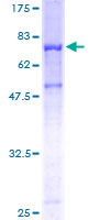 PSAP / Prosaposin Protein - 12.5% SDS-PAGE of human PSAP stained with Coomassie Blue