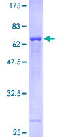 PSAT1 Protein - 12.5% SDS-PAGE of human PSAT1 stained with Coomassie Blue