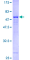 PSAT1 Protein - 12.5% SDS-PAGE of human PSAT1 stained with Coomassie Blue