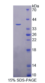 PSAT1 Protein - Recombinant  Phosphoserine Aminotransferase 1 By SDS-PAGE