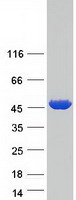 PSAT1 Protein - Purified recombinant protein PSAT1 was analyzed by SDS-PAGE gel and Coomassie Blue Staining