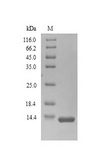 PSCA Protein - (Tris-Glycine gel) Discontinuous SDS-PAGE (reduced) with 5% enrichment gel and 15% separation gel.