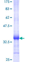 PSCA Protein - 12.5% SDS-PAGE Stained with Coomassie Blue.