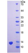 PSCA Protein - Recombinant Prostate Stem Cell Antigen By SDS-PAGE