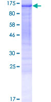 PSD2 Protein - 12.5% SDS-PAGE of human PSD2 stained with Coomassie Blue