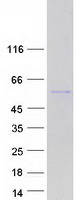 PSD3 Protein - Purified recombinant protein PSD3 was analyzed by SDS-PAGE gel and Coomassie Blue Staining